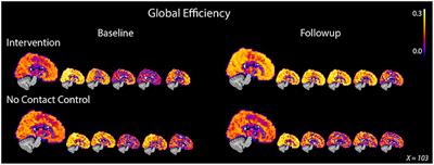 Improvisational Movement to Improve Quality of Life in Older Adults With Early-Stage Dementia: A Pilot Study